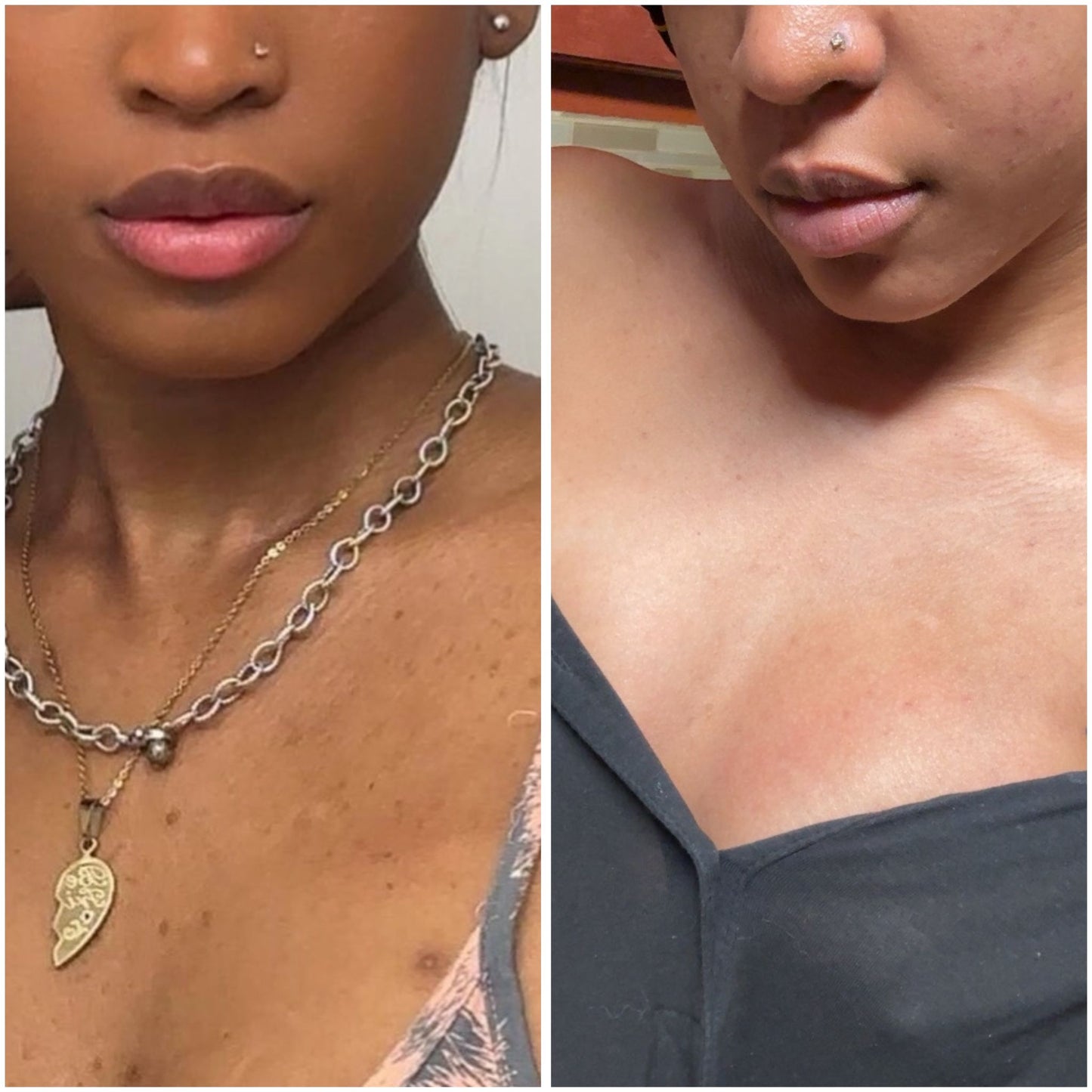 GAMA+3  COMBO REPARATION DE LA PIEL