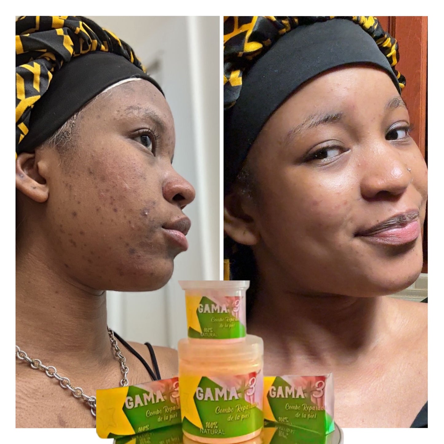 GAMA+3  COMBO REPARATION DE LA PIEL